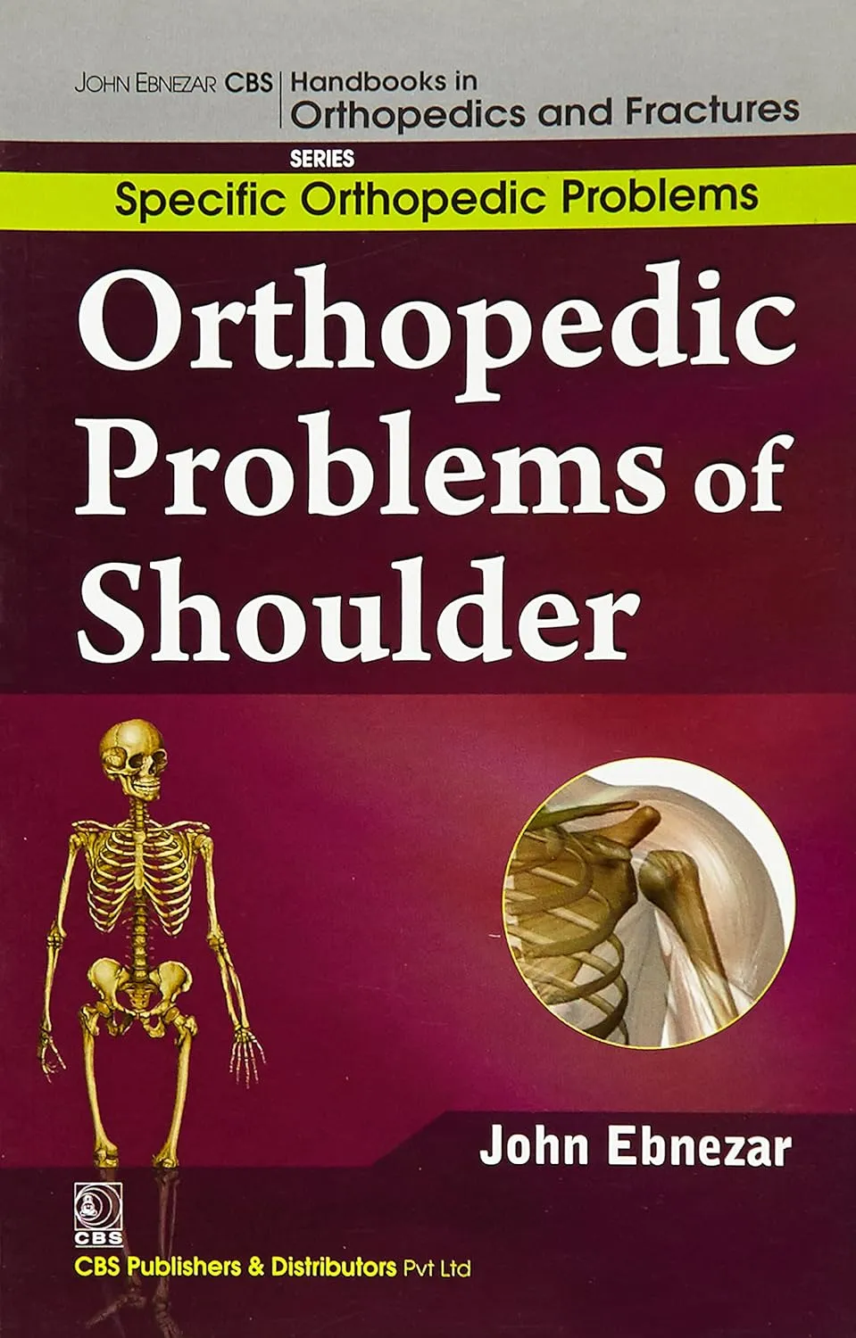 John Ebnezar CBS Handbooks in Orthopedics and Fractures Specific Orthopedic Problems Orthopedic Problems of Shoulder