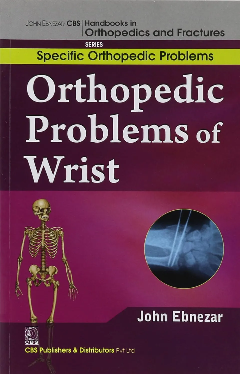 John Ebnezar CBS Handbooks in Orthopedics and Fractures Specific Orthopedic Problems  Orthopedic Problems of Wrist