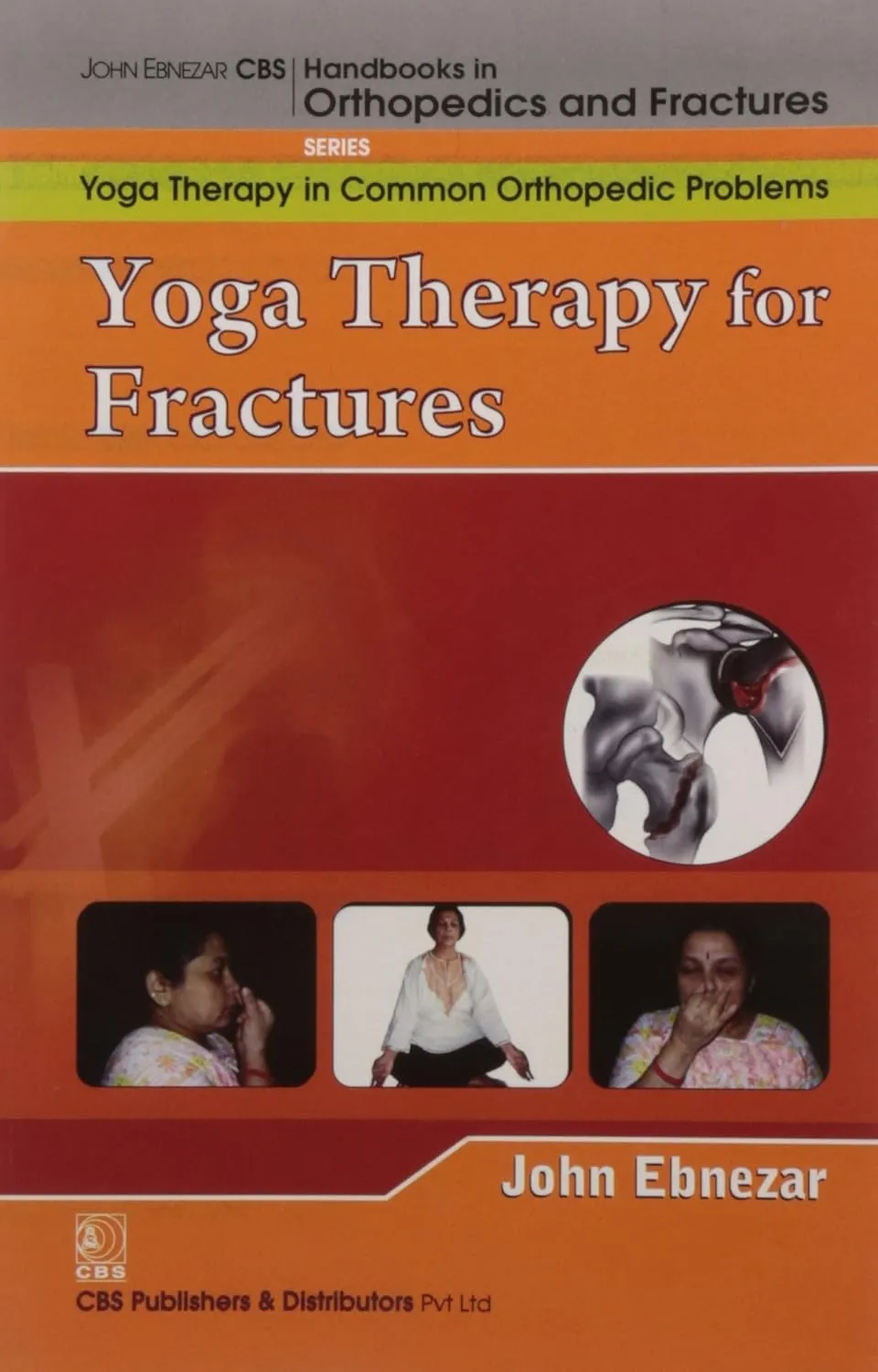 John Ebnezar CBS Handbooks in Orthopedics and Fractures Yoga Therapy in Common Orthopedic Problems  Yoga Therapy for Fractures