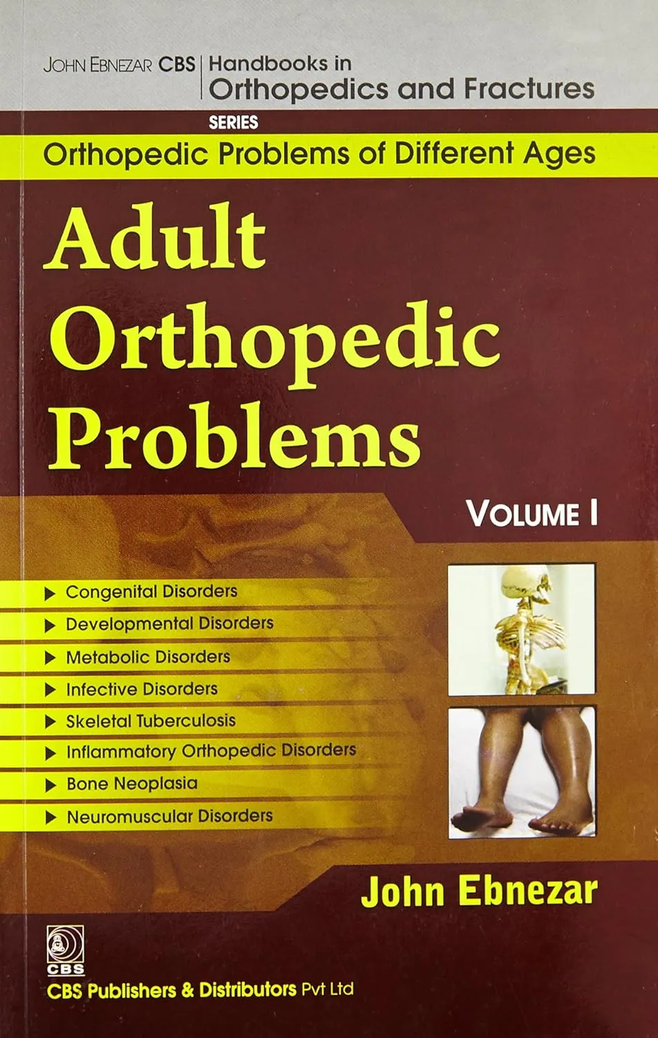 John Ebnezar Series | Adults Orthopedic Problems Volume I