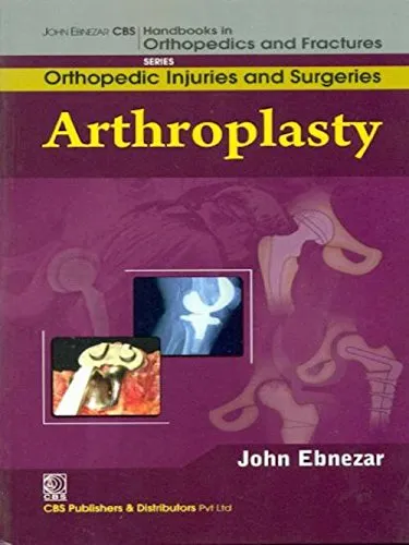 John Ebnezar Series | Arthroplasty