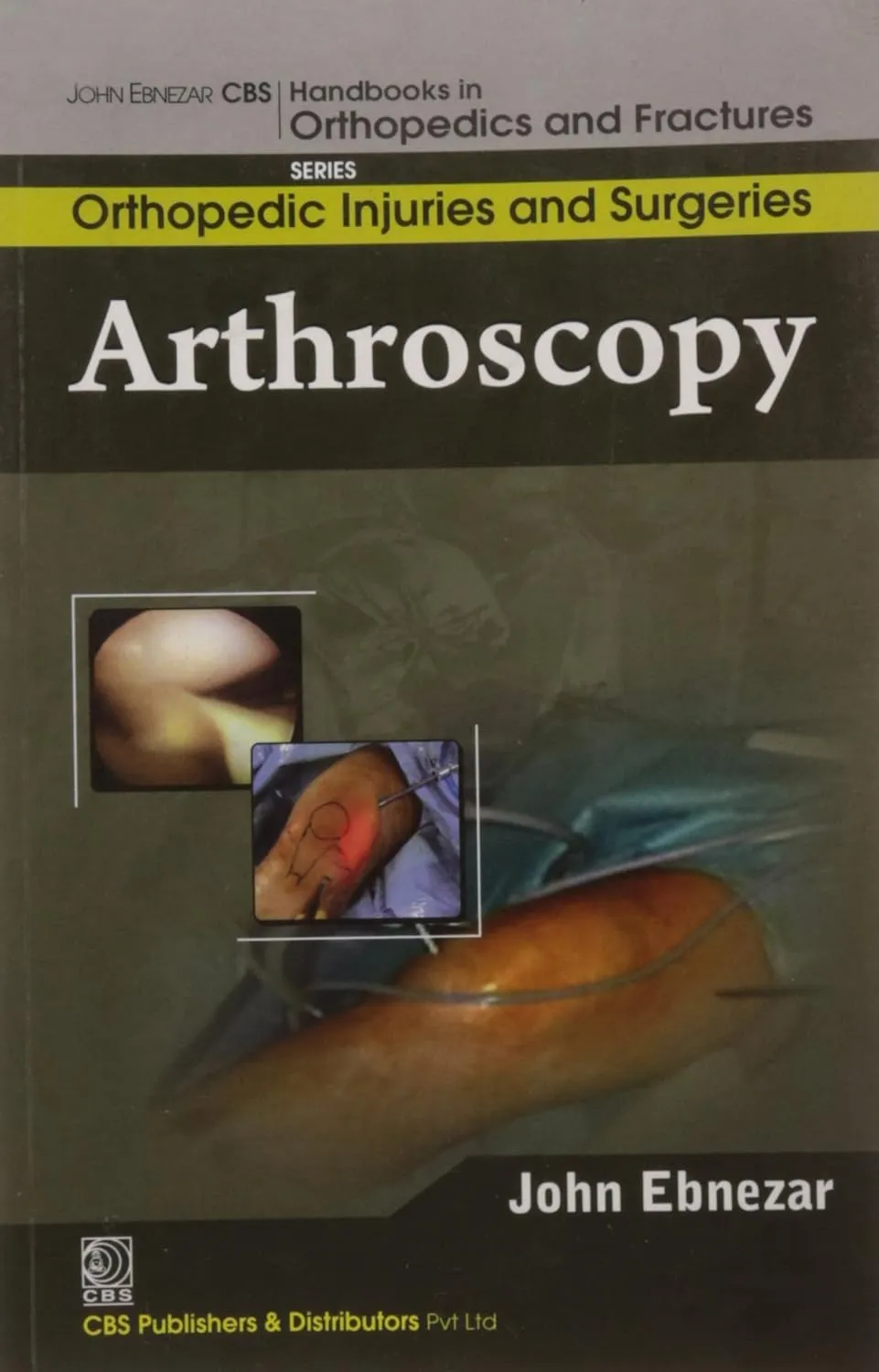John Ebnezar Series | Arthroscopy