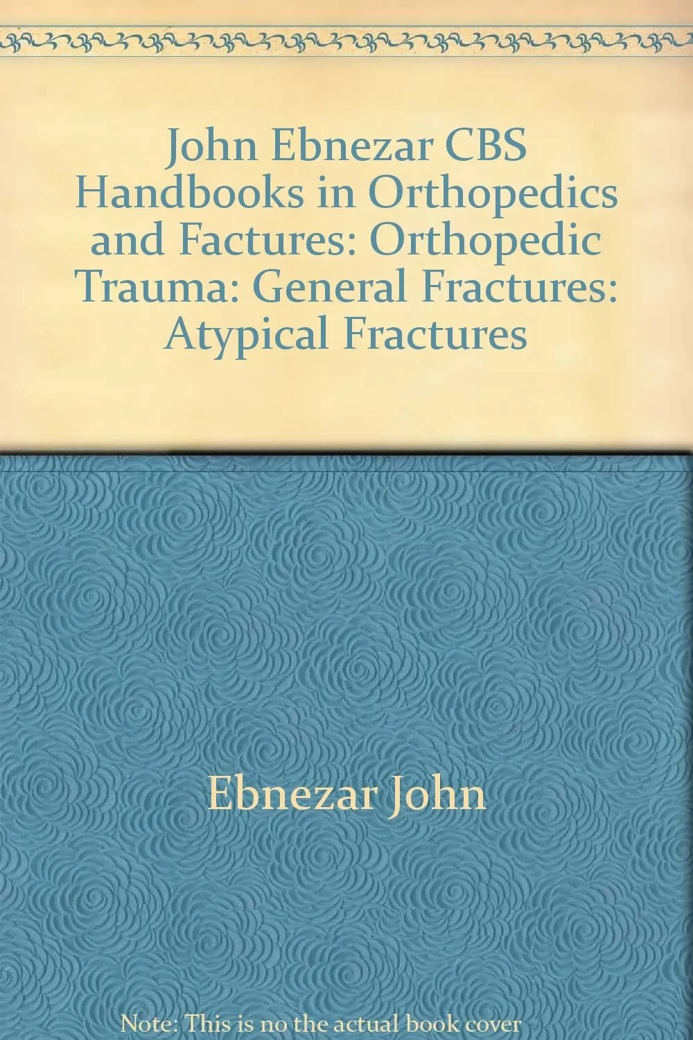 John Ebnezar Series | Atypical Fractures