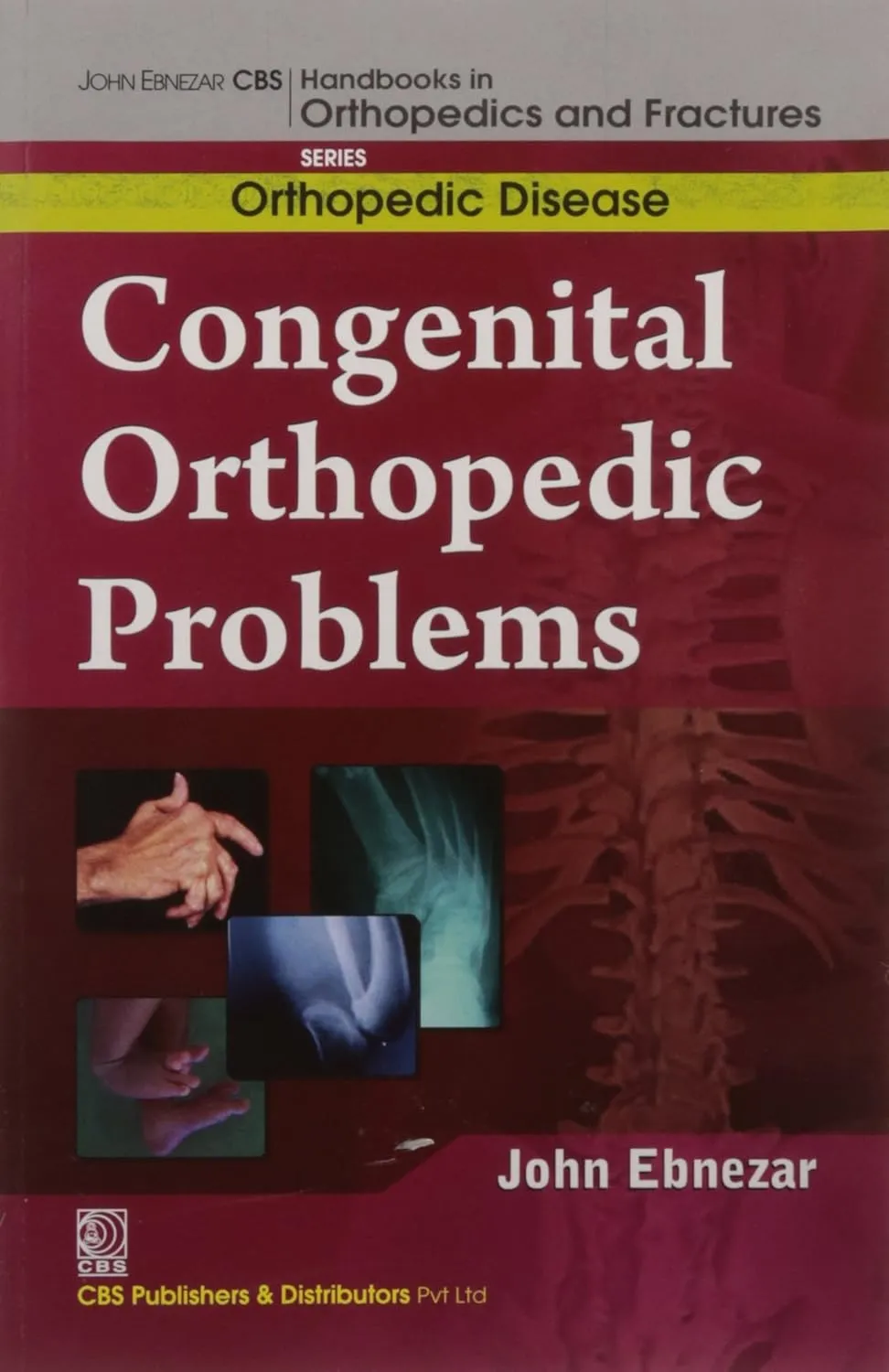 John Ebnezar Series | Congenital Orthopedic Problems