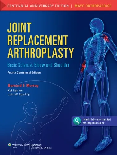 Joint Replacement Arthroplasty | 4th Edition