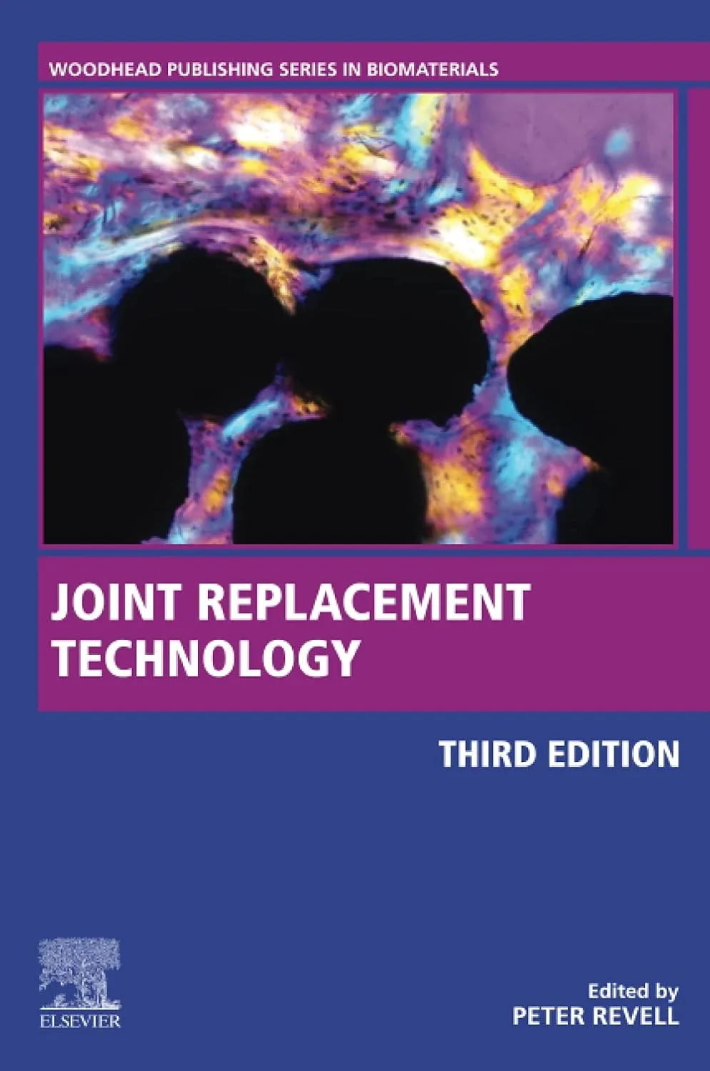 Joint Replacement Technology Third Edition | Paperback