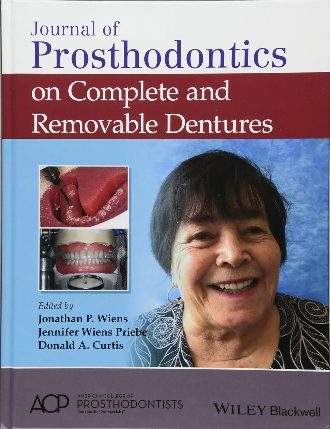 Journal Of Prosthodontics On Complete And Removable Dentures | Hardcover