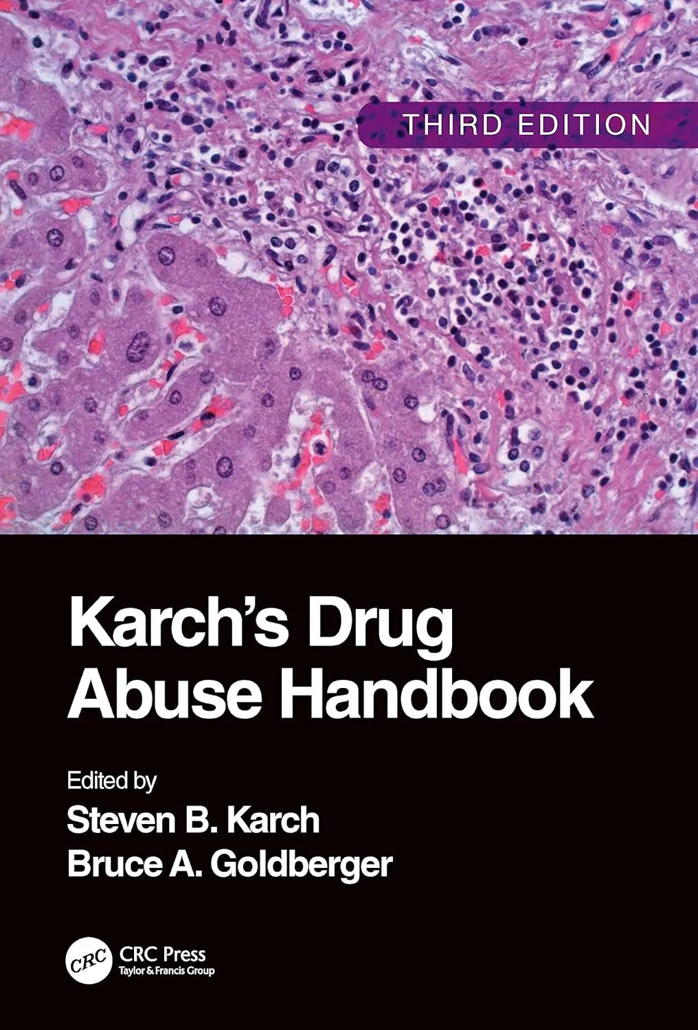 Karchs Drug Abuse Handbook Third Edition | Hardcover