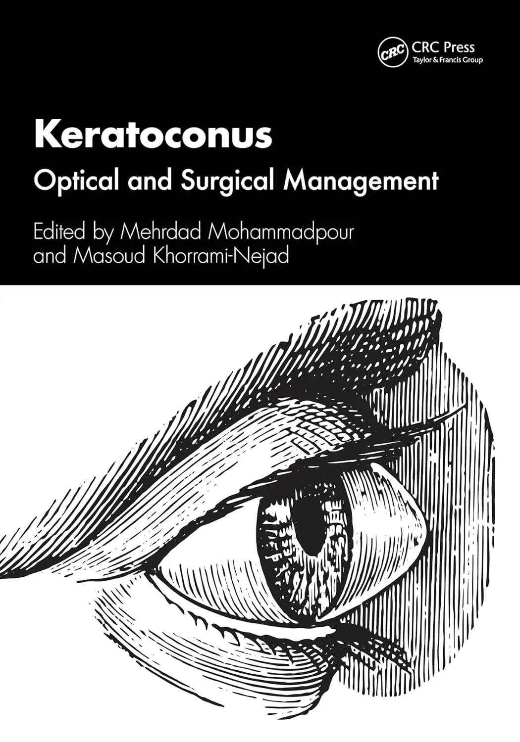 Keratoconus Optical And Surgical Management | Paperback