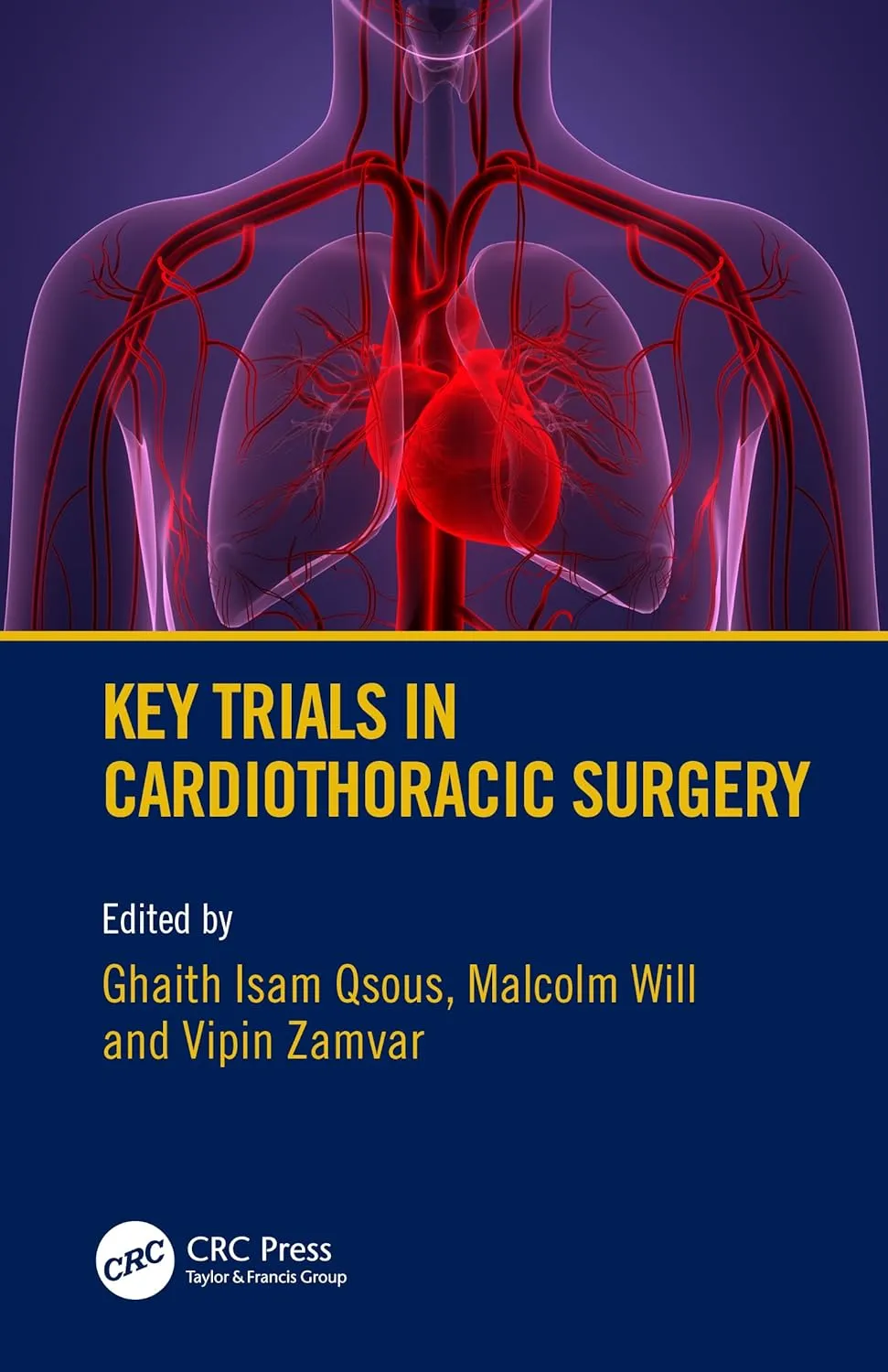 Key Trials In Cardiothoracic Surgery | Paperback