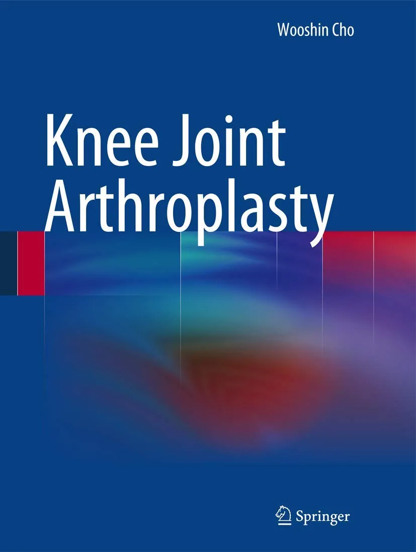 Knee Joint Arthroplasty | Hardcover