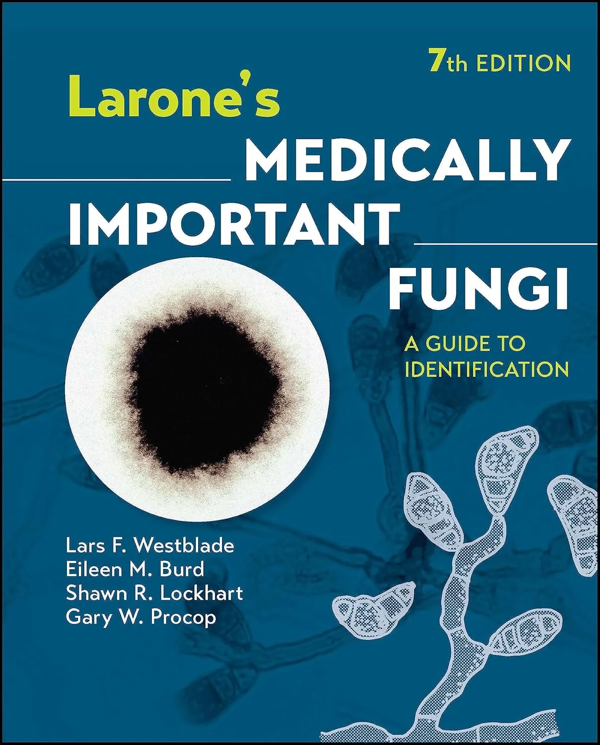 Larones Medically Important Fungi A Guide To Identification 7th Edition | Hardcover