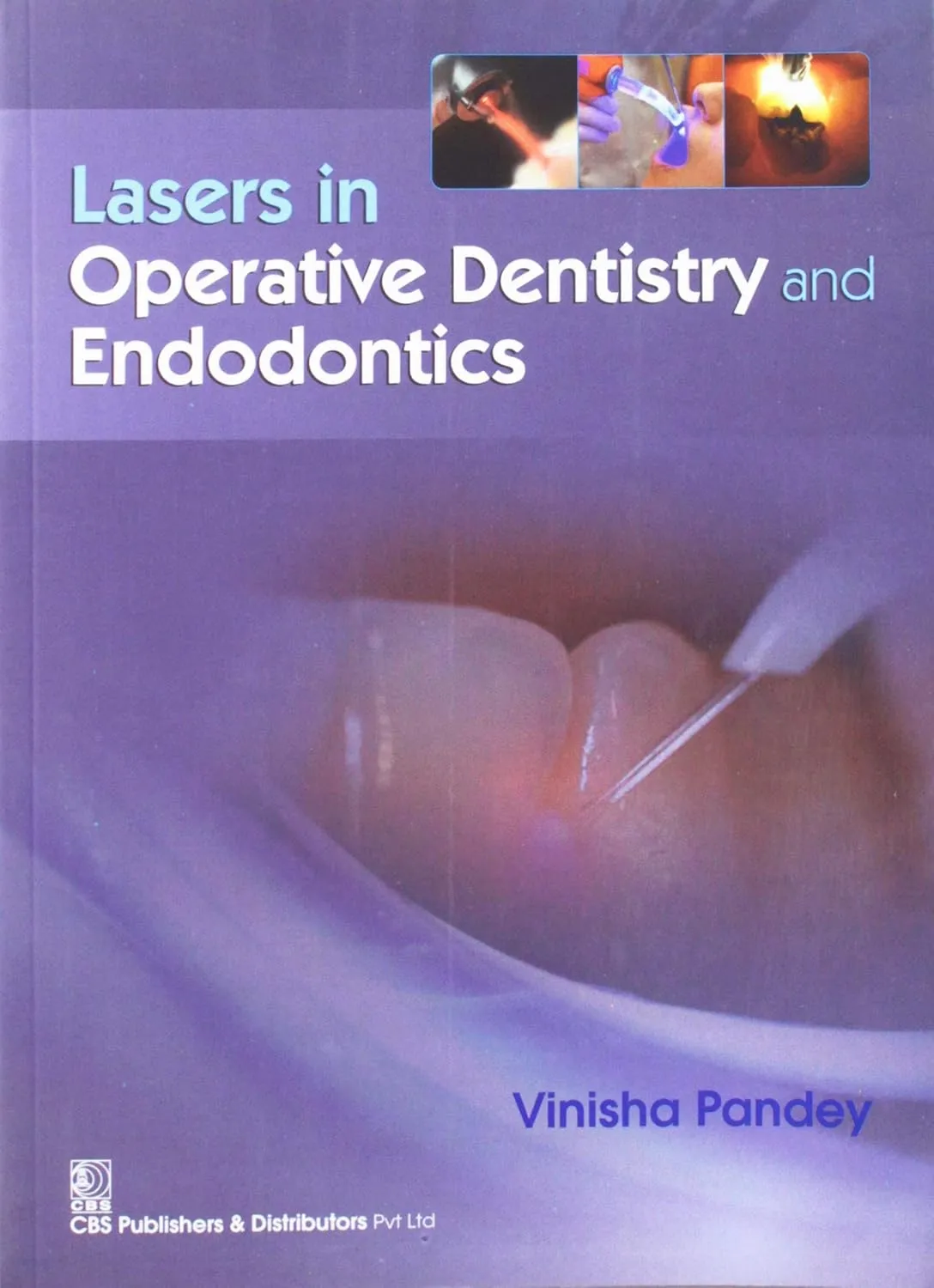 Lasers in Operative Dentistry and Endodontics | Paperback