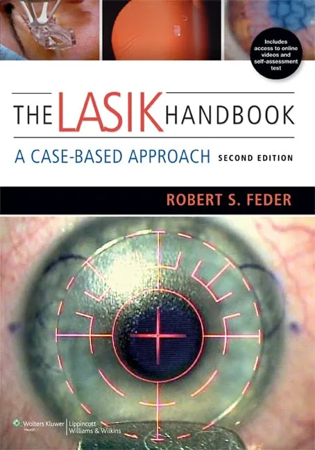 The Lasik Handbook A Case-Based Approach | 2nd Edition | Paperback