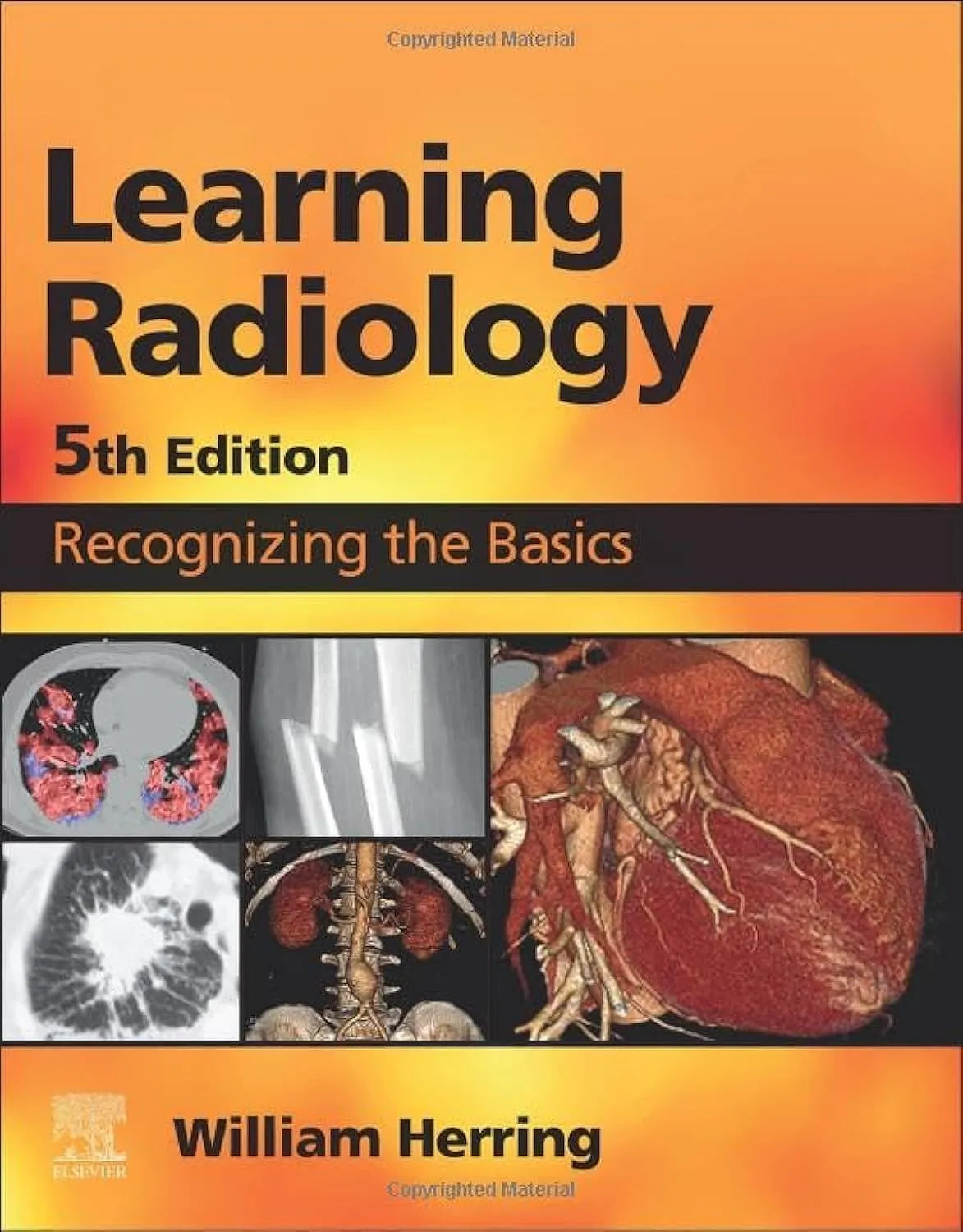 Learning Radiology Recognizing The Basics With Access Code | 5th Edition | Paperback