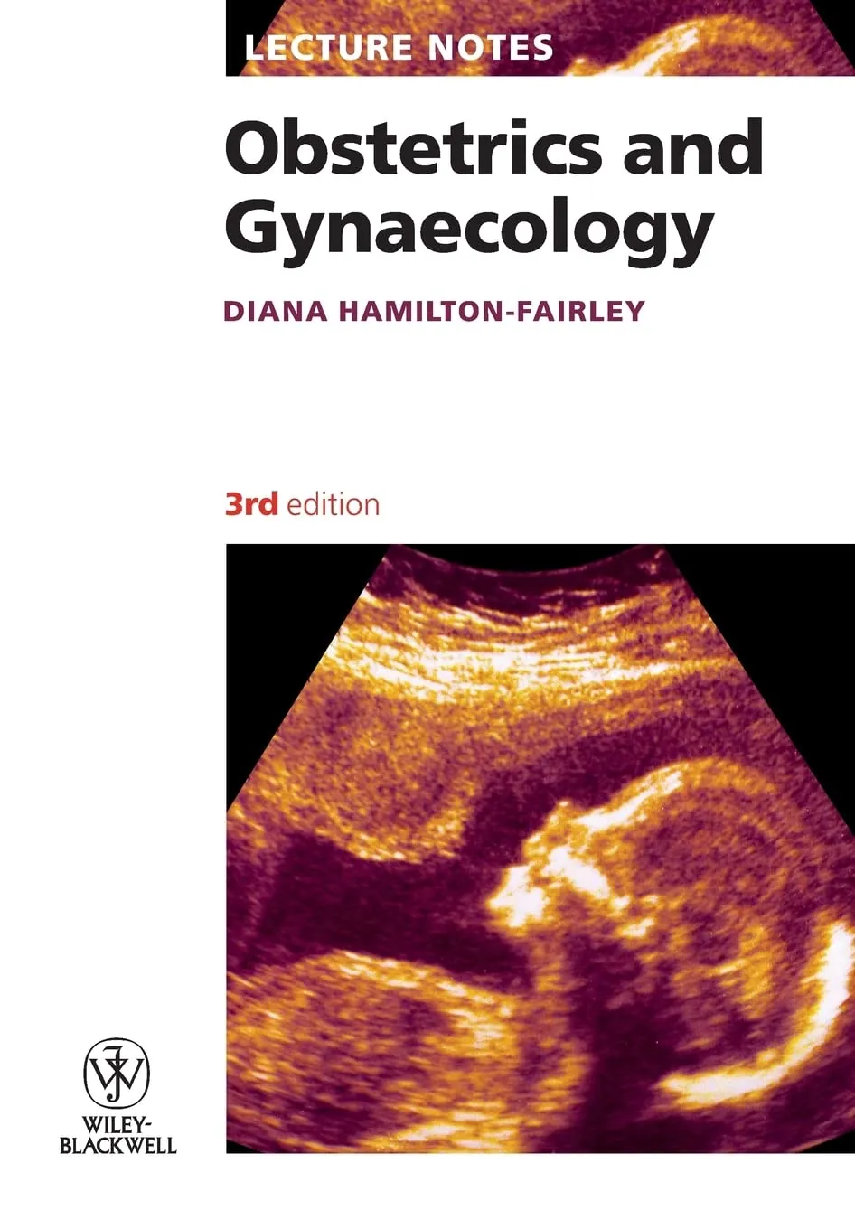 Lecture Notes Obstetrics and Gynaecology | Third Edition | Paperback