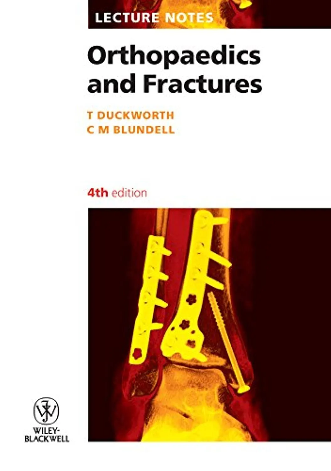 Lecture Notes Orthopaedics and Fractures | 4th Edition | Paperback