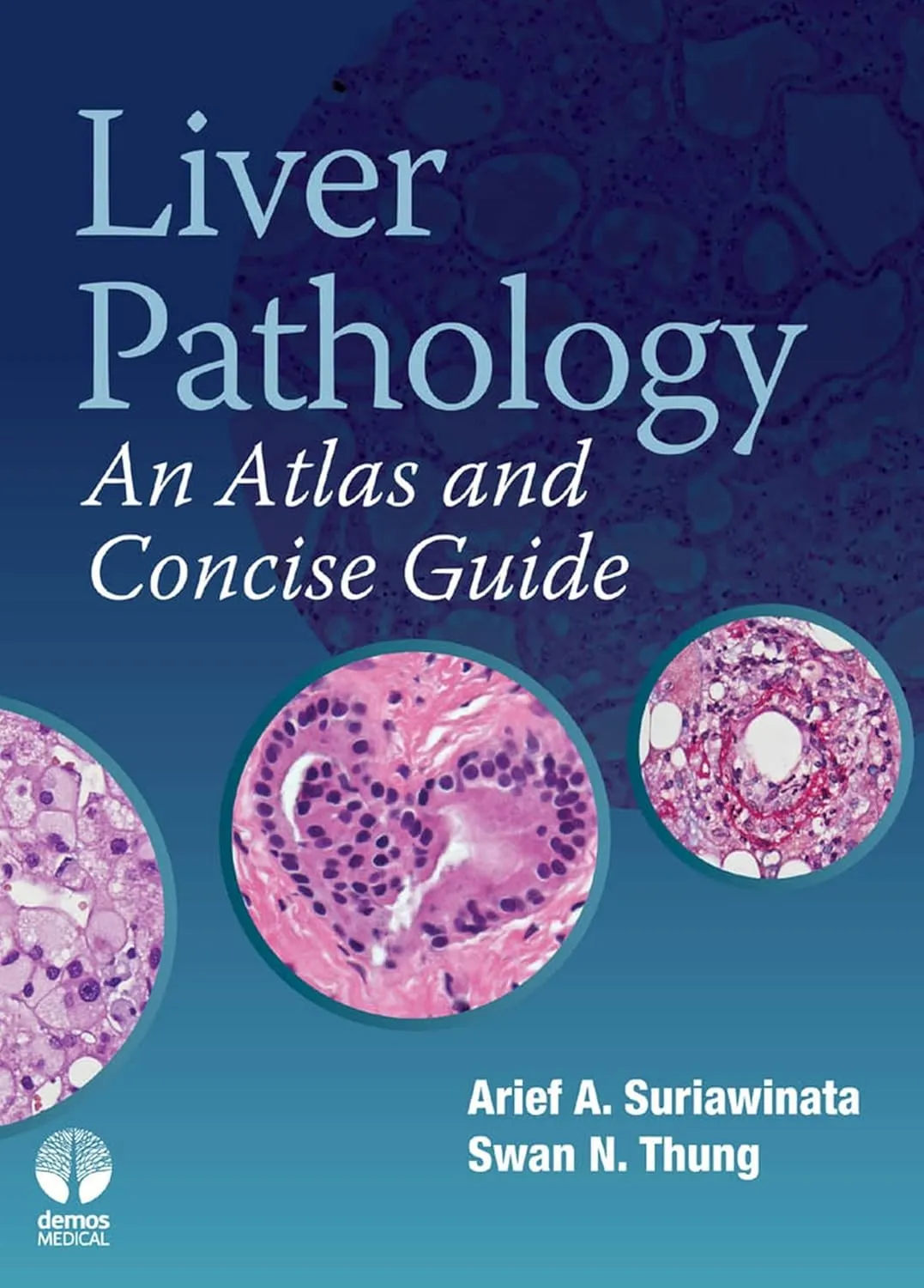 Liver Pathology An Atlas and Concise Guide | Hardcover