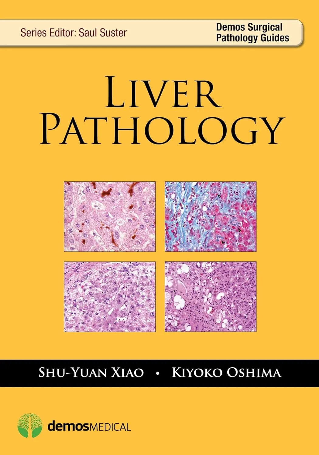 Liver Pathology | Paperback