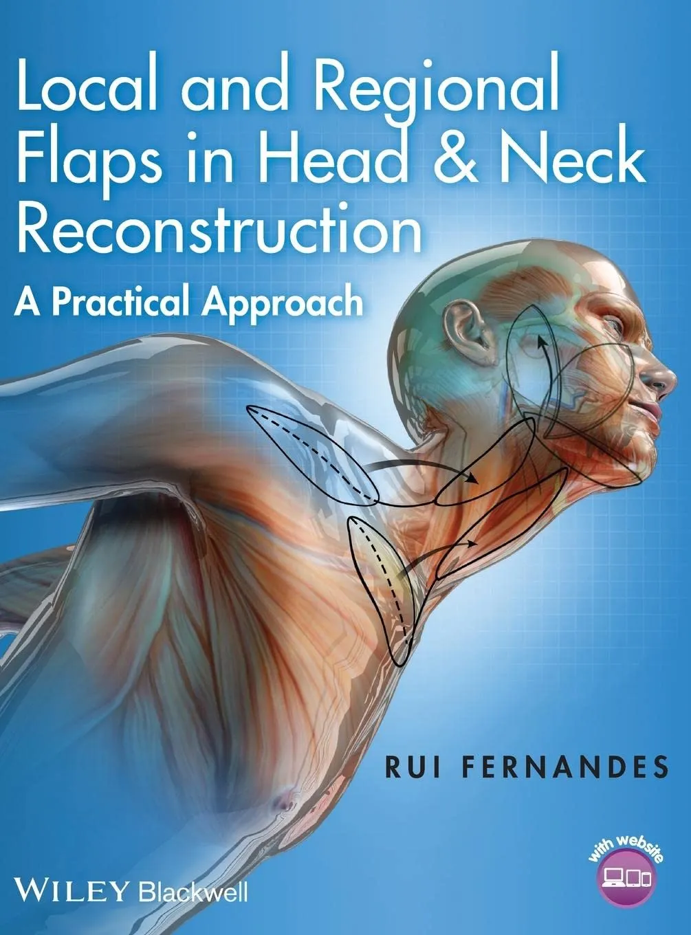 Local and Regional Flaps in Head and Neck Reconstruction A Practical Approach | Hardcover