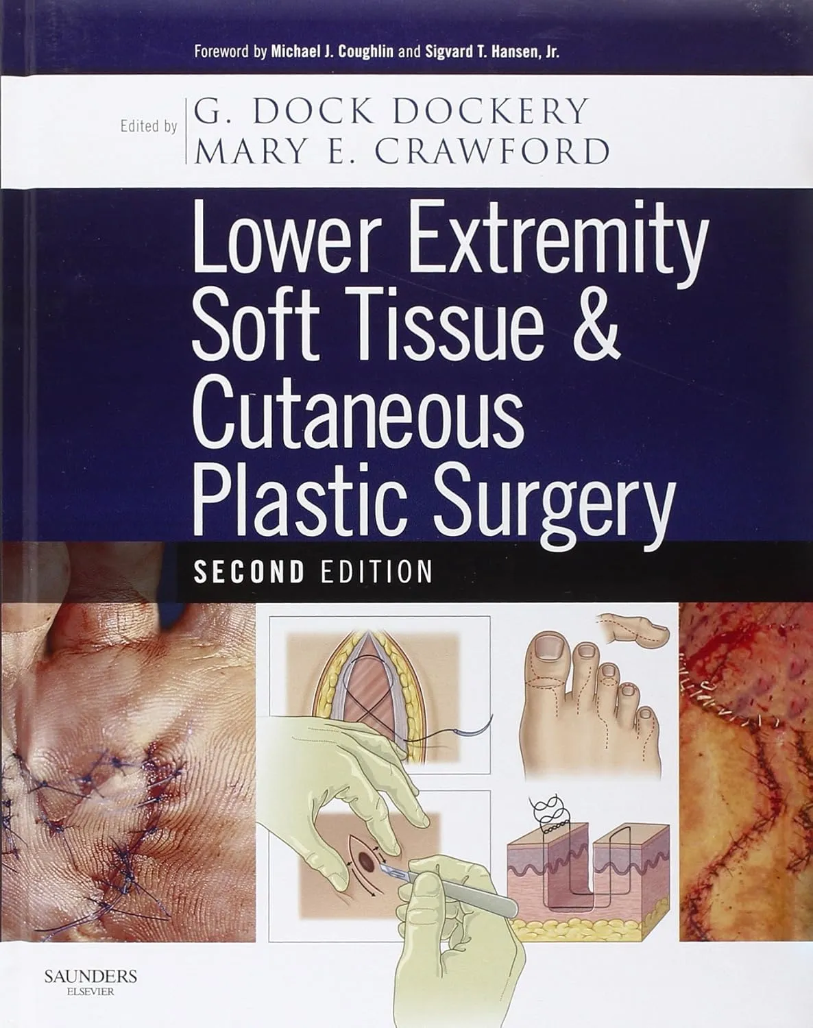 Lower Extremity Soft Tissue and Cutaneous Plastic Surgery | 2nd Edition | Hardcover