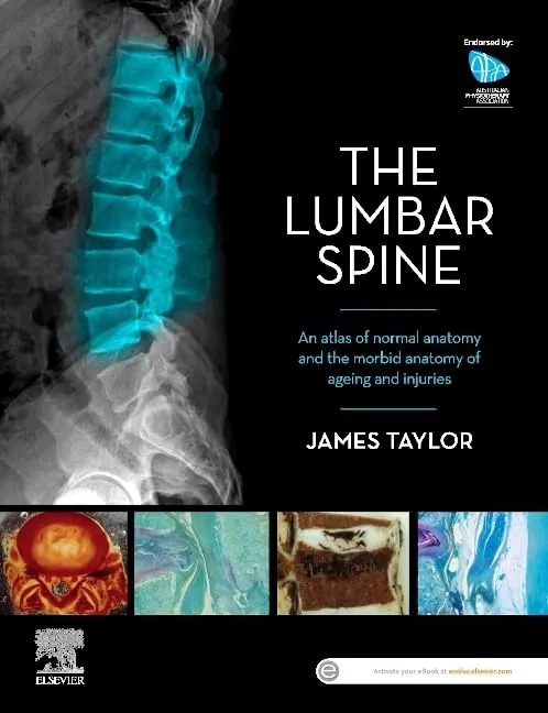 The Lumbar Spine An Atlas Of Normal Anatomy And The Morbid Anatomy Of Ageing And Injury | Paperback