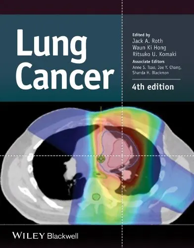 Lung Cancer | 4th Edition | Hardcover