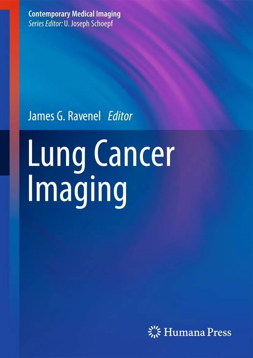 Lung Cancer Imaging | Hardcover