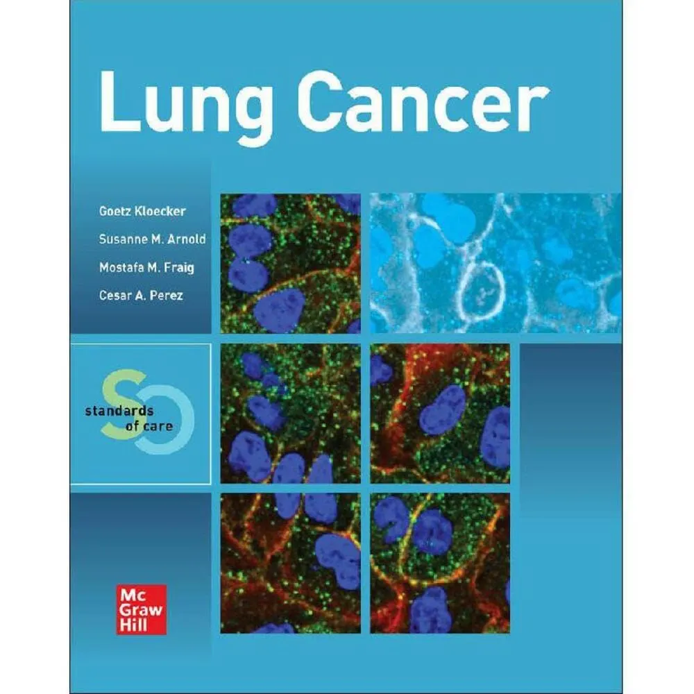 Lung Cancer Standards Of Care | Paperback