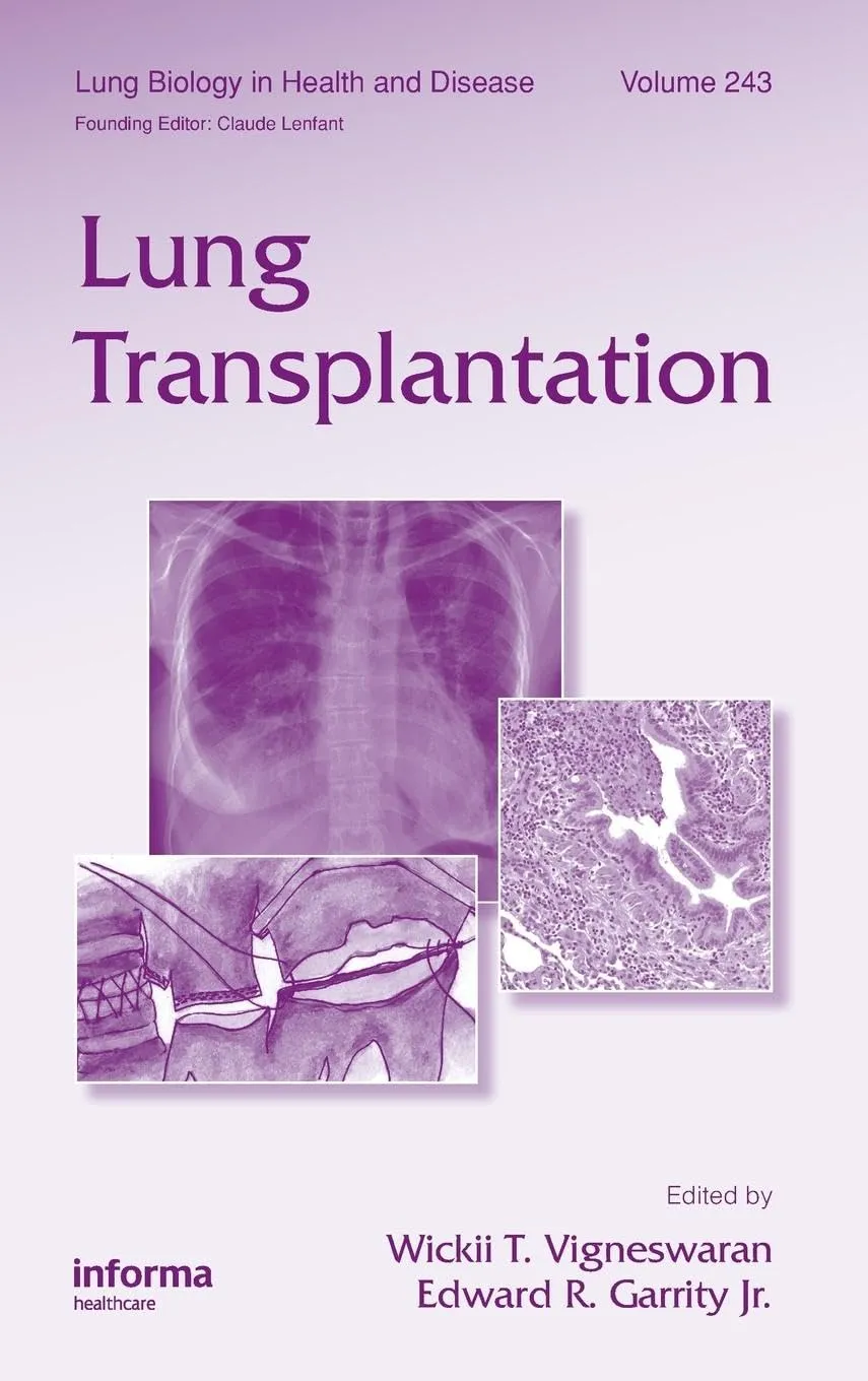 Lung Transplantation Lung Biology in Health and Disease Series | Hardcover