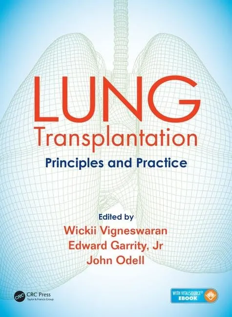 Lung Transplantation Principles and Practice | Hardcover