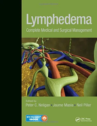 Lymphedema Complete Medical and Surgical Management | Hardcover