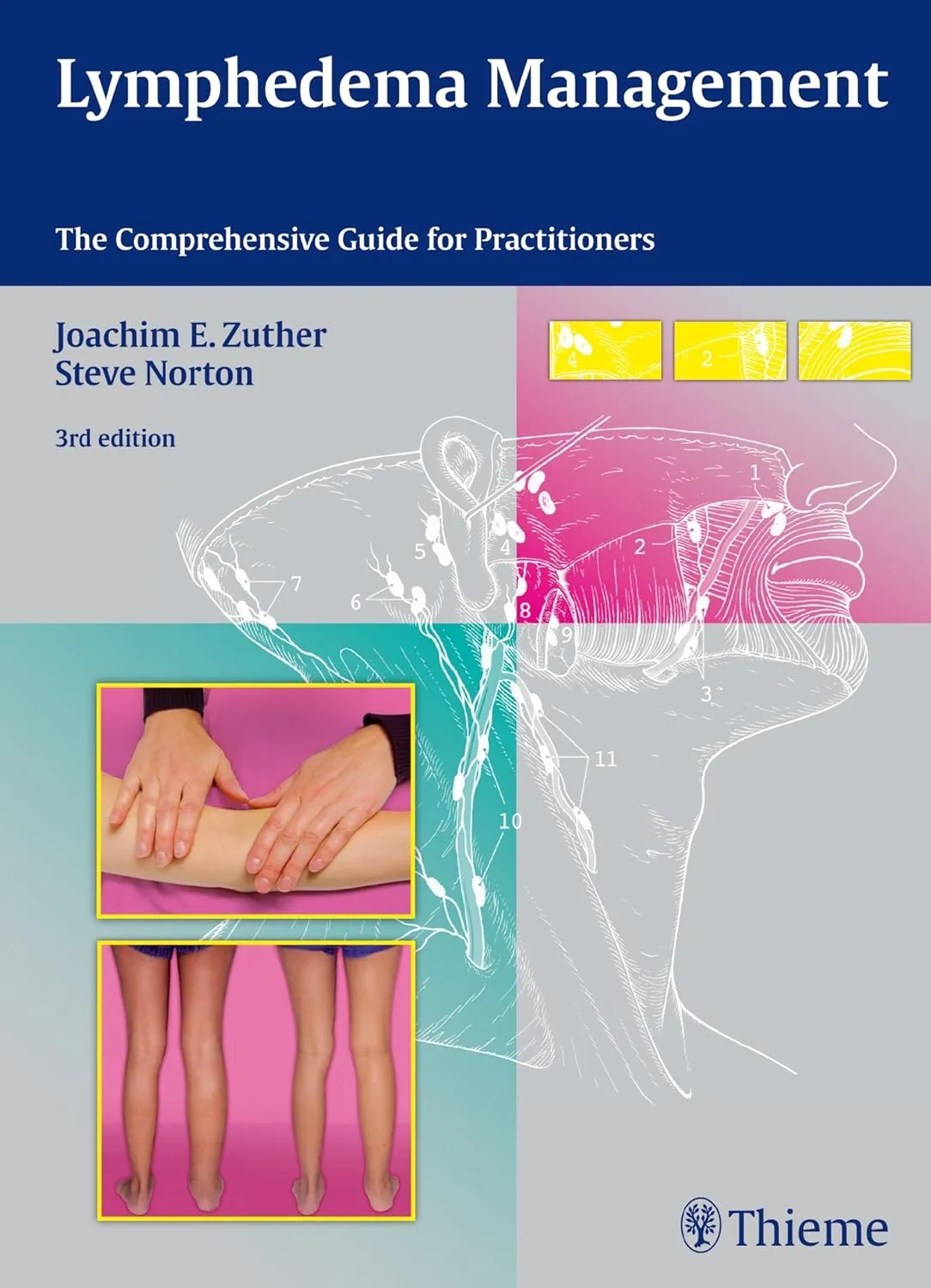 Lymphedema Management The Comprehensive Guide for Practitioners | Third Edition | Hardcover