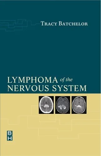 Lymphoma of the Nervous System | Hardcover