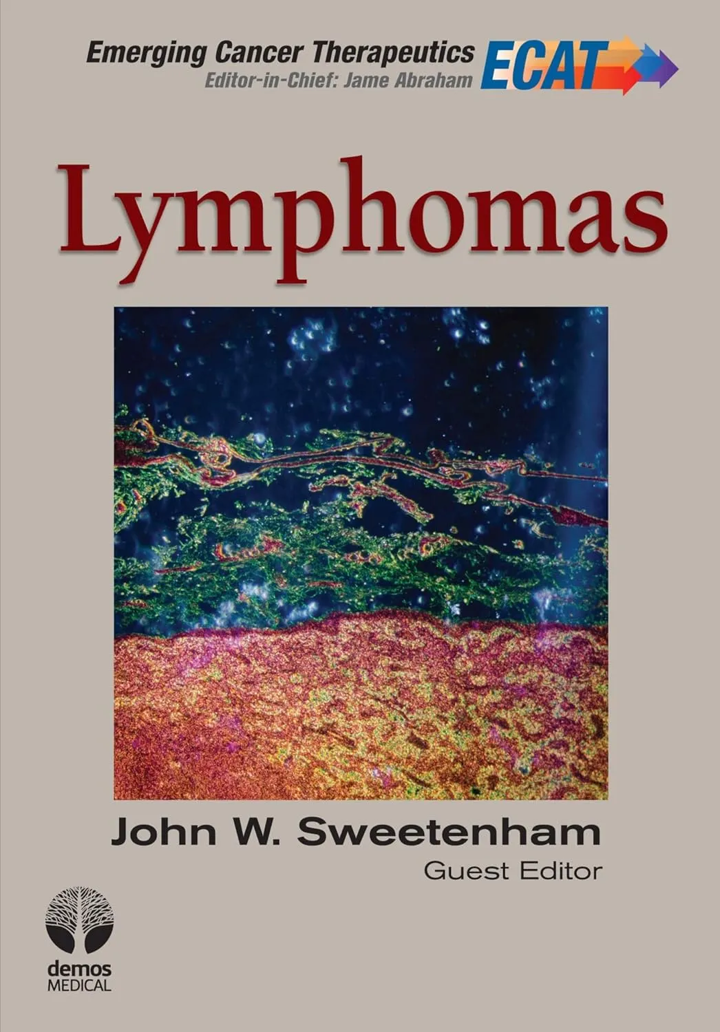 Lymphomas | Hardcover