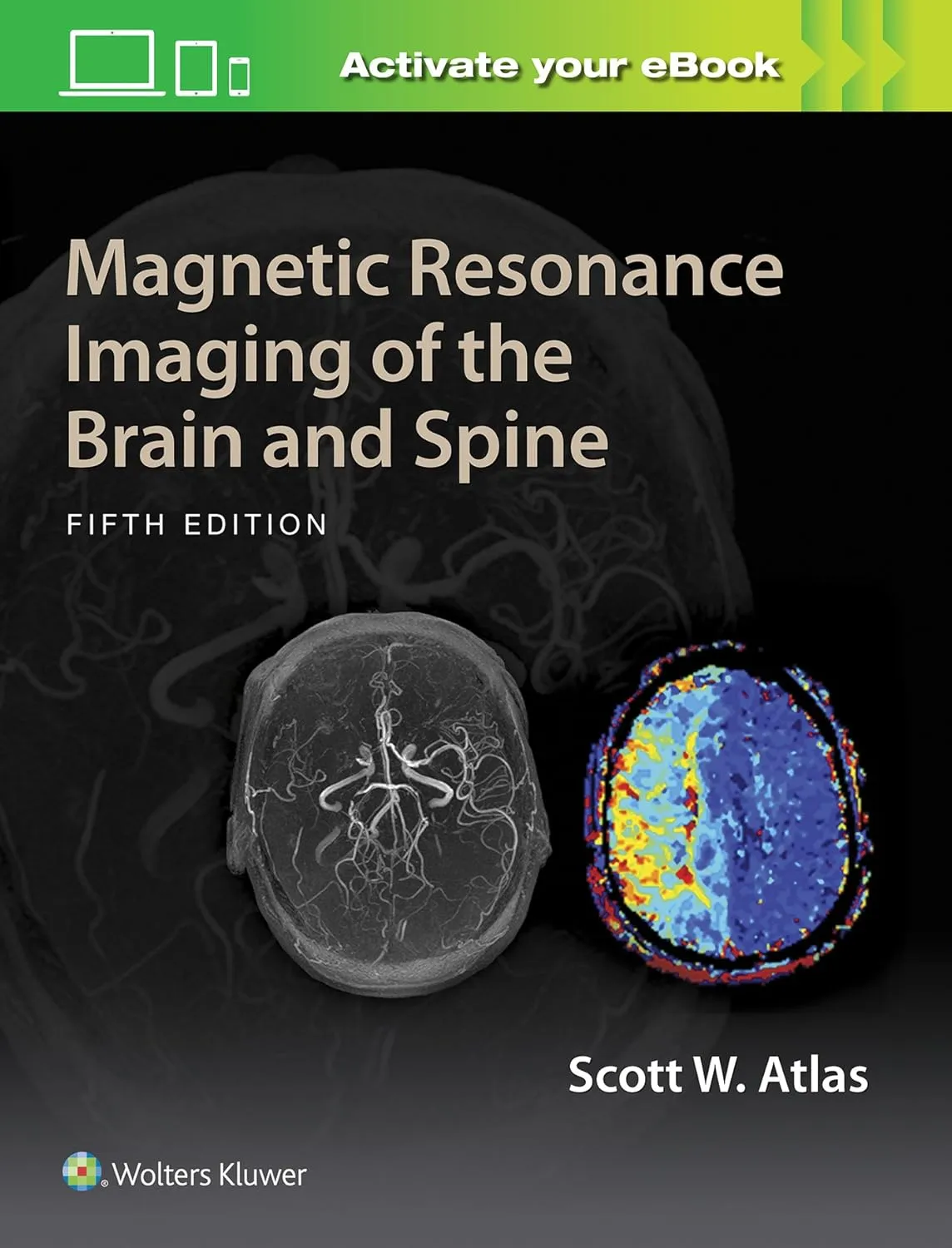 Magnetic Resonance Imaging of the Brain and Spine | 5th Edition | Hardcover