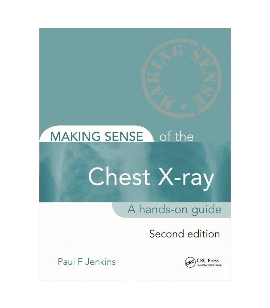 Making Sense of the Chest X-Ray A Hands-on Guide | 2nd Edition ( Spl. Reprint) (Original Price £25.99)