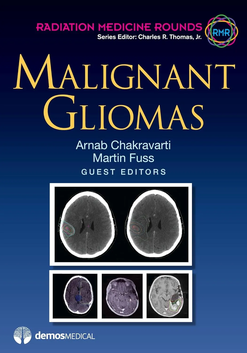 Malignant Gliomas | Hardcover