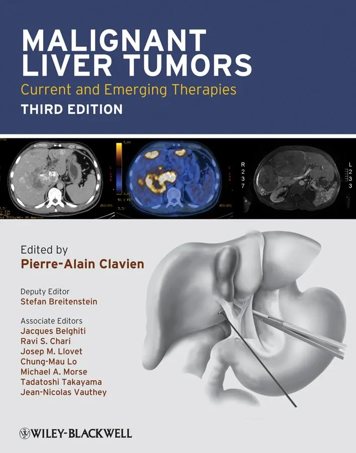 Malignant Liver Tumors Current and Emerging Therapies | Third Edition | Hardcover