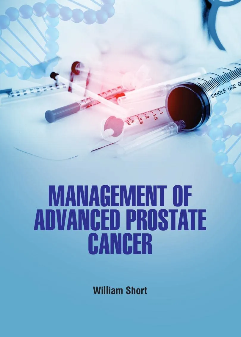 Management Of Advanced Prostate Cancer | Hardcover