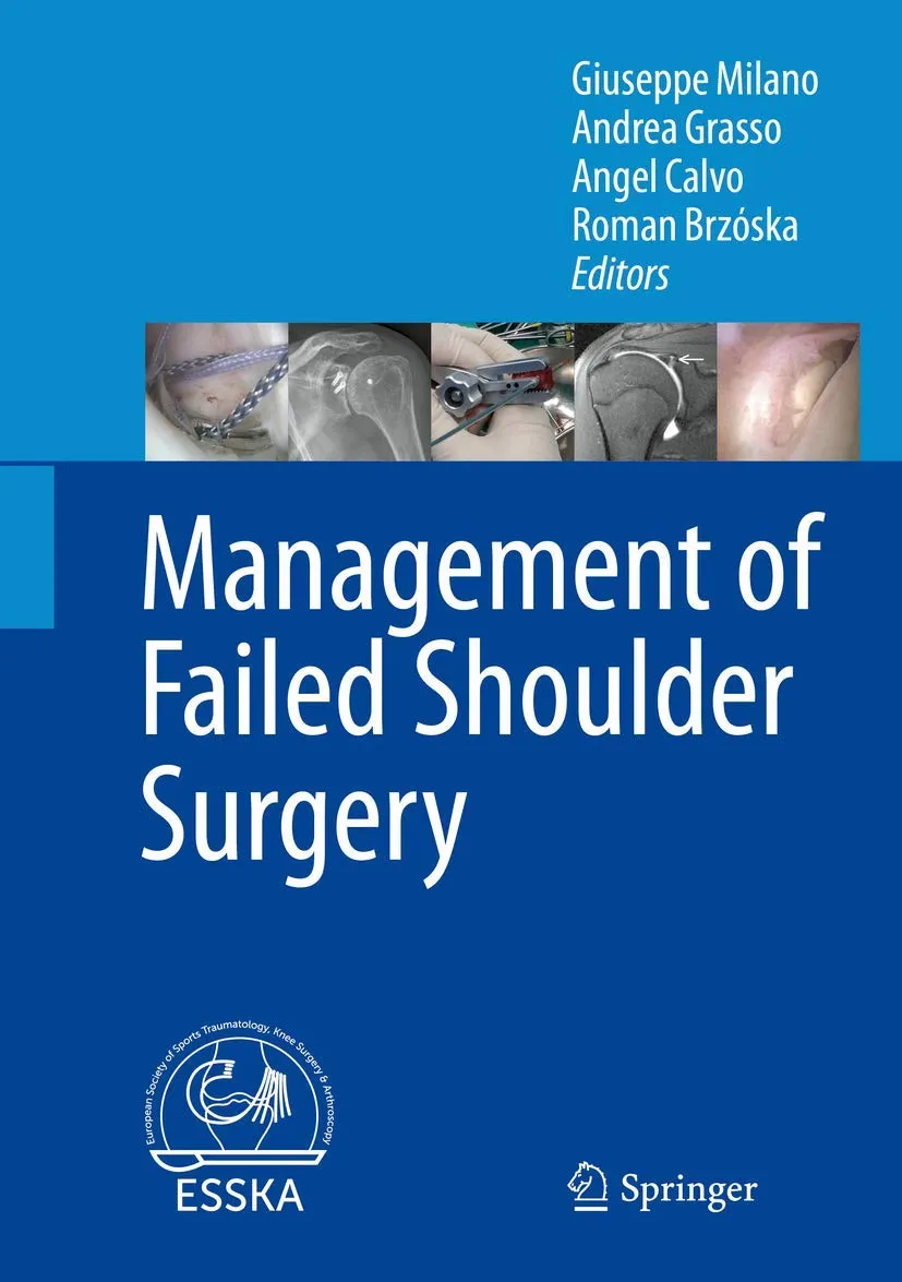 Management of Failed Shoulder Surgery | Hardcover