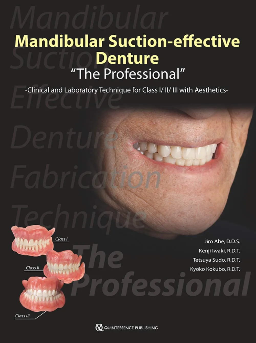 Mandibular Suction Effective Denture The Professional Laboratory Technique For Class I/Ii/Iii With Aesthetics | PaperbackProfessioonal Laboratory Technique