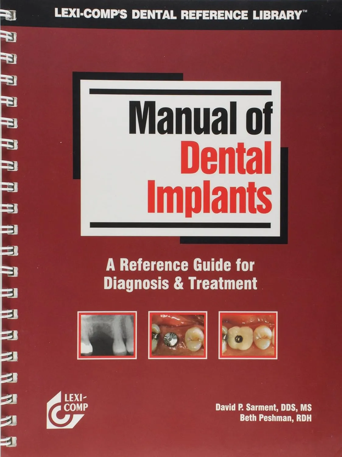 Manual of Dental Implants A Reference Guide for Diagnosis and Treatment (Four Colours) | Paperback