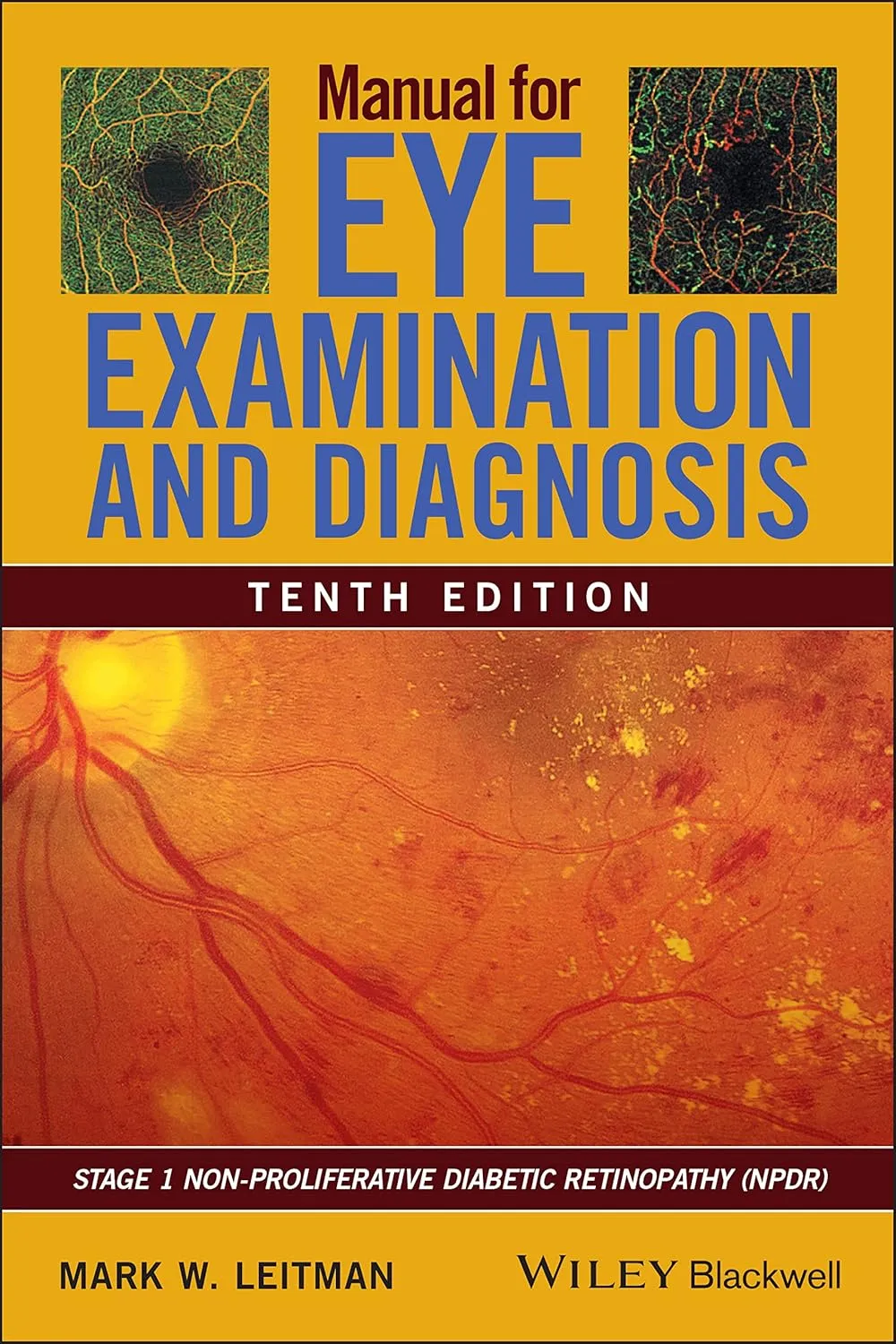 Manual For Eye Examination And Diagnosis 10th Edition | Paperback
