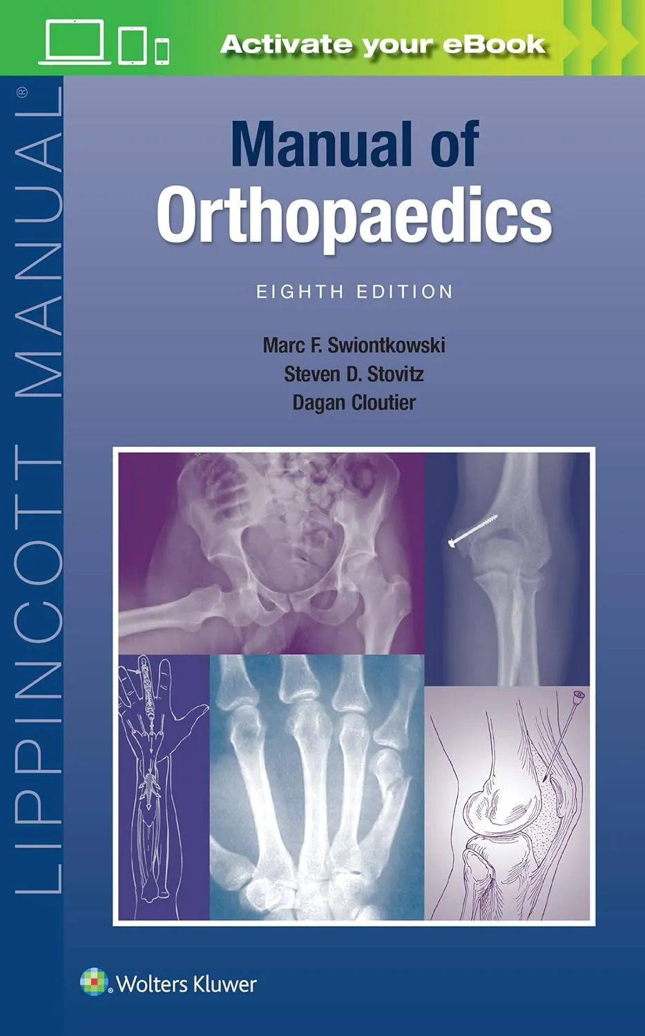 Manual Of Orthopaedics 8th Edition | Paperback