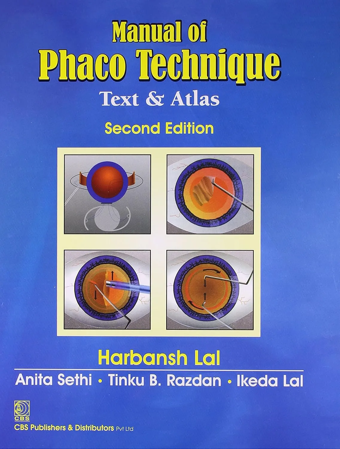 Manual of Phaco Technique (Text and Atlas) | 2nd Edition
