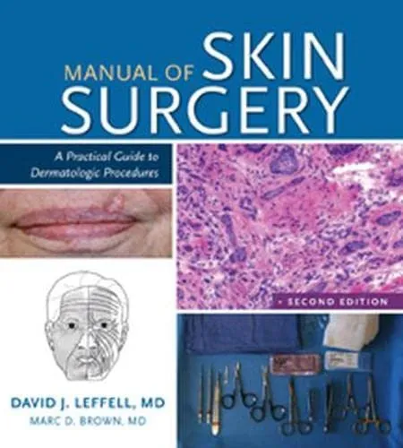 Manual of Skin A Practical Guide To Dermatologic Procedures | 2nd Edition | Paperback