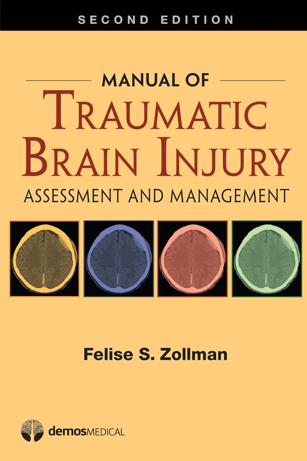 Manual of Traumatic Brain Injury | 2nd Edition | Paperback