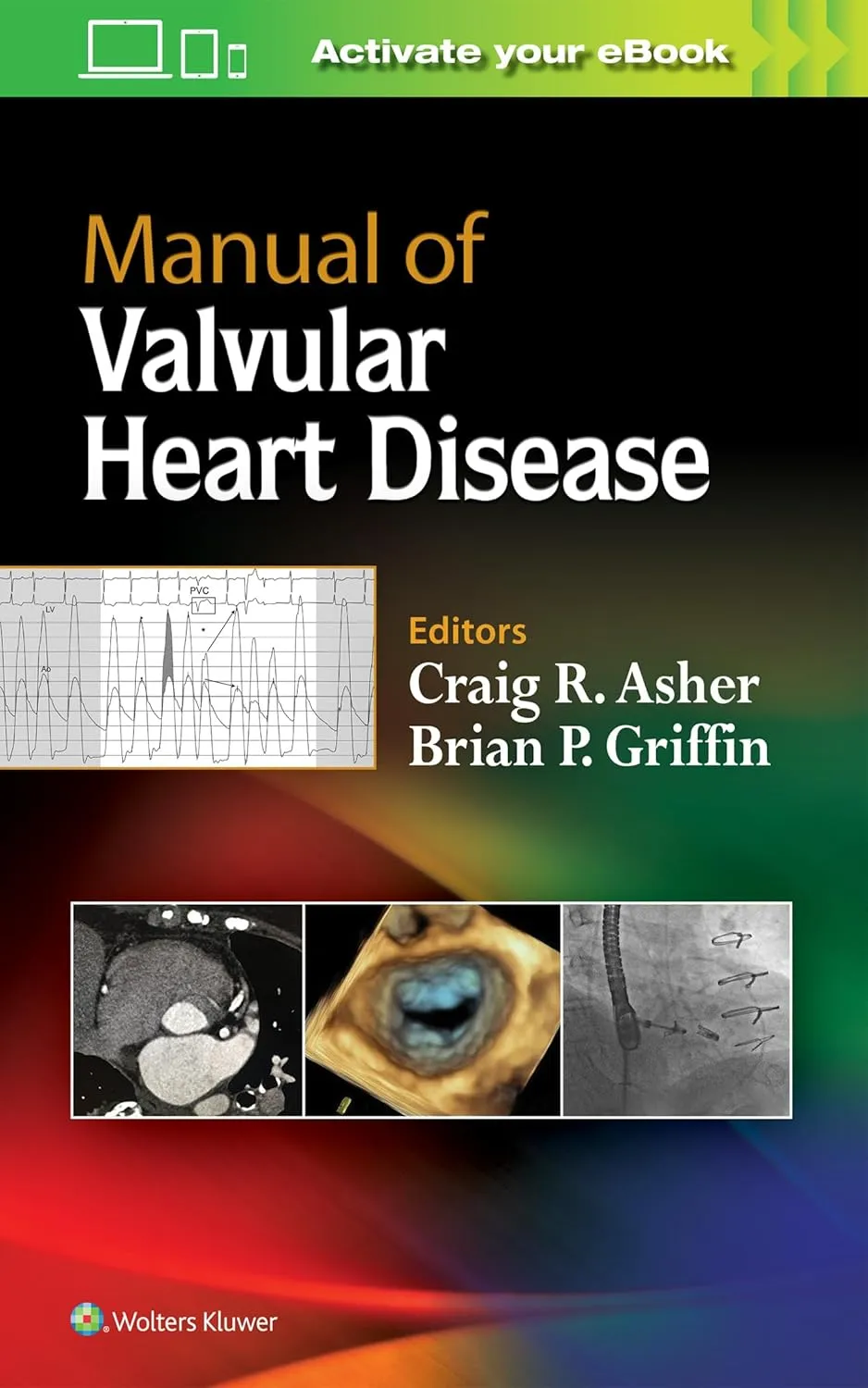 Manual of Valvular Heart Disease | Paperback