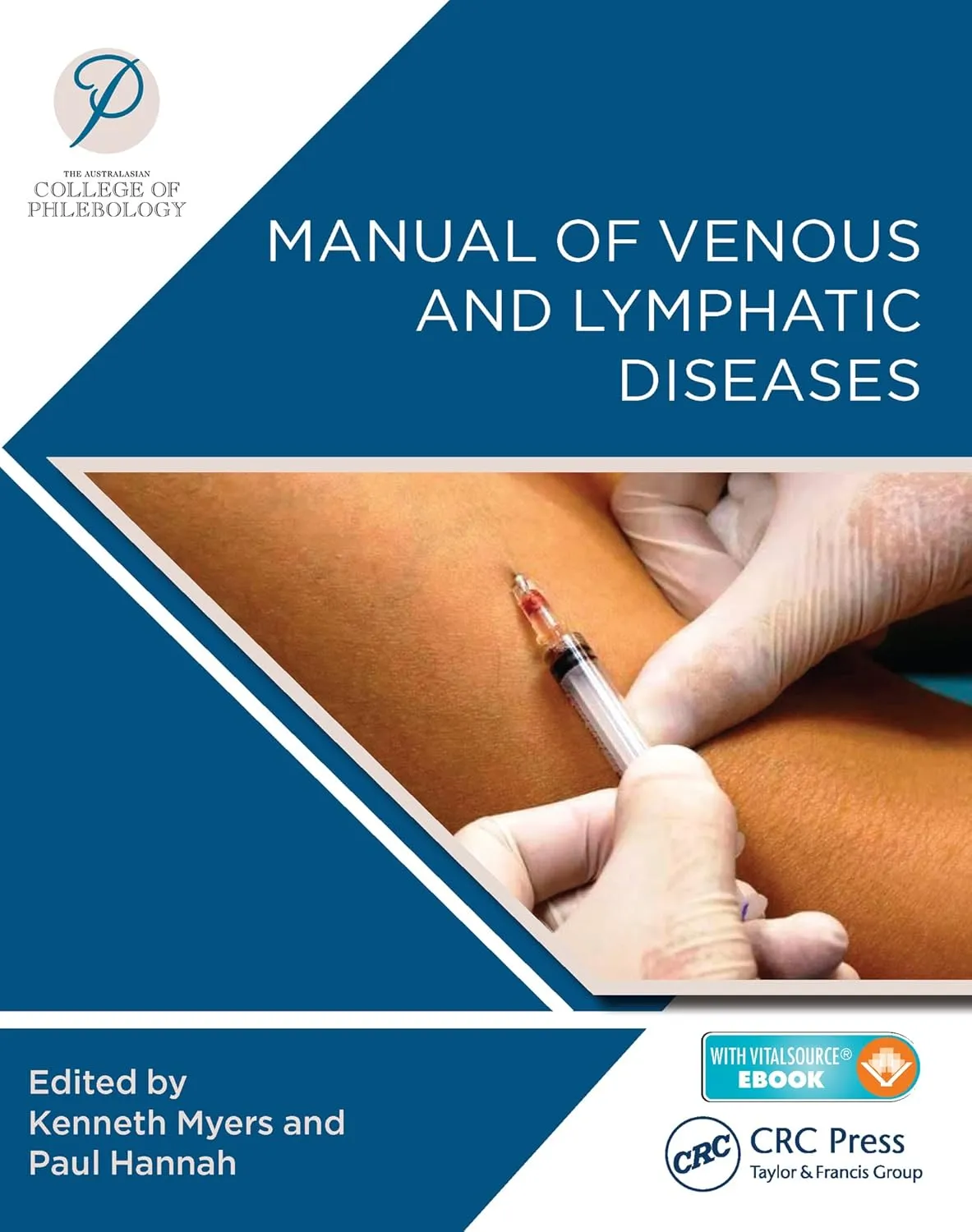 Manual of Venous and Lymphatic Diseases | Paperback